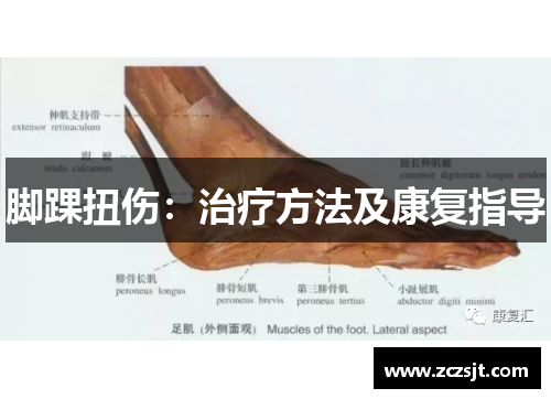 脚踝扭伤：治疗方法及康复指导